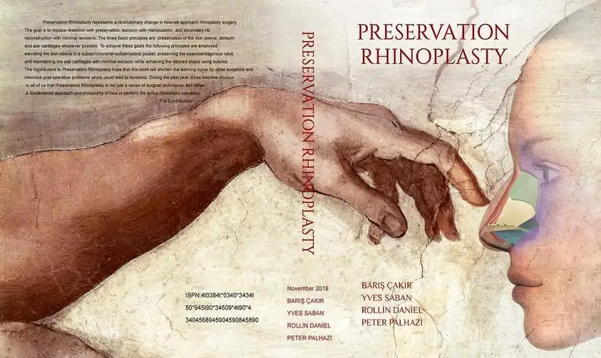 1 (1) Rinoplastia Preservadora: O Guia Completo da Técnica Revolucionária